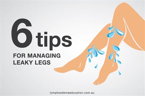 6 tips for managing leaky legs